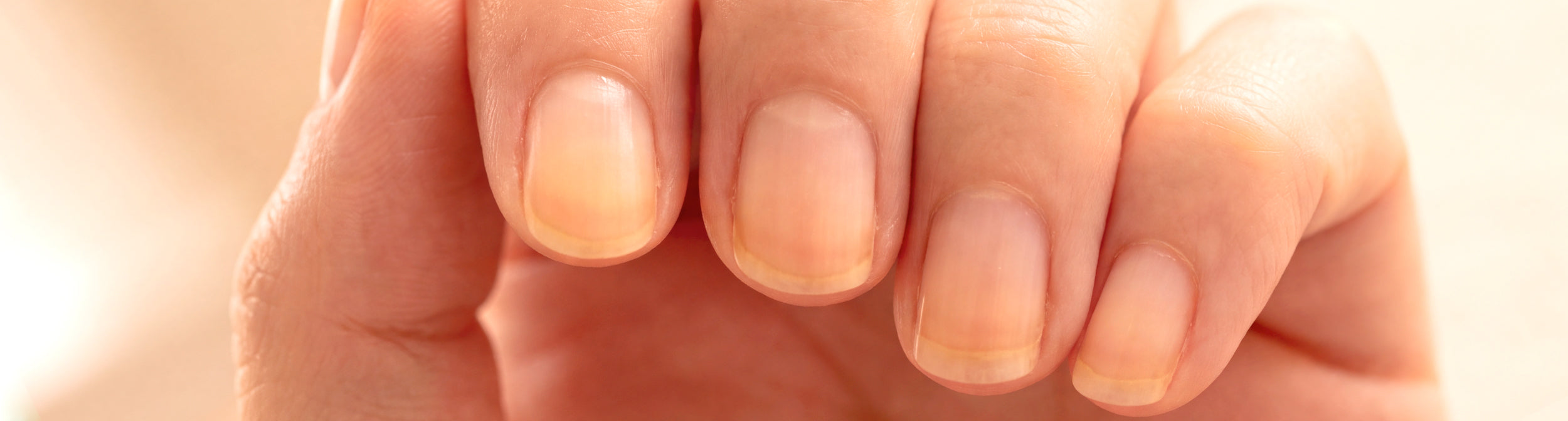 uñas naturales amarillas
